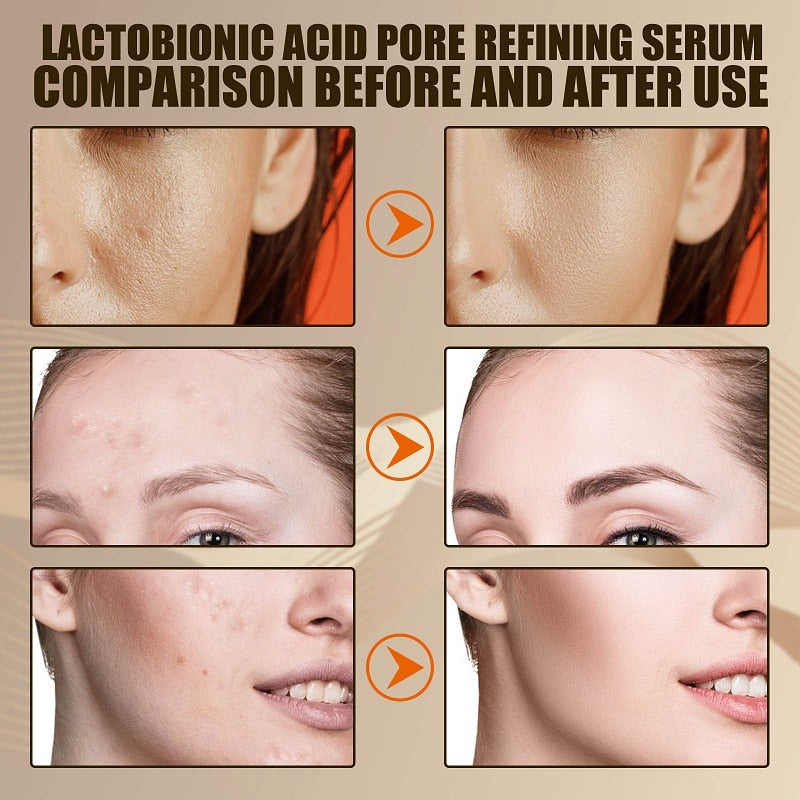 Lactobionic Acid Pore Refining Face Serum