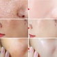 Lactobionic Acid Pore Refining Face Serum